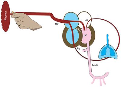 Umbilical Cord Milking: A Review